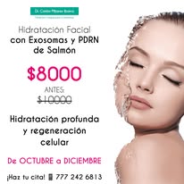 Promoción 4
